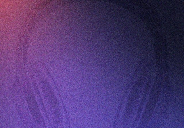 7c436ce297fd6561a6ad62127b61beb91ab982abd28478f92e5869b859061fdc94d5ca183b19b74ee852c2727edba24419ff6f1c6032e9858c67a53c43ff1a76